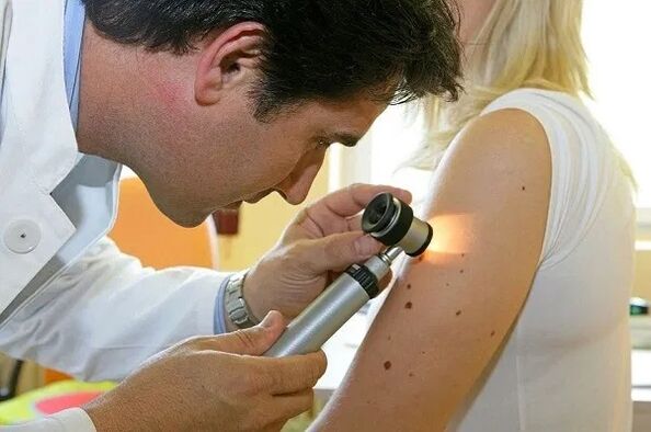 papilomaren diagnostikoa